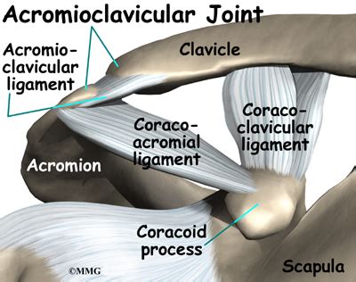 Osteoarthritis of the Acromioclavicular Joint - eOrthopod.com