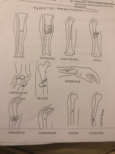 Chapter 7 The Skeletal System Flashcards Quizlet