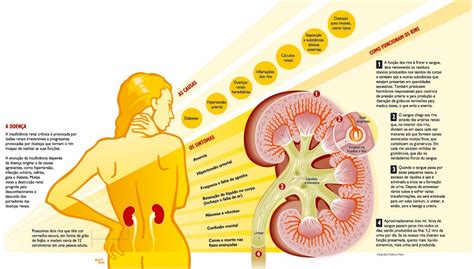 Blog Professor Robson INFOGRÁFICO Insuficiência Renal