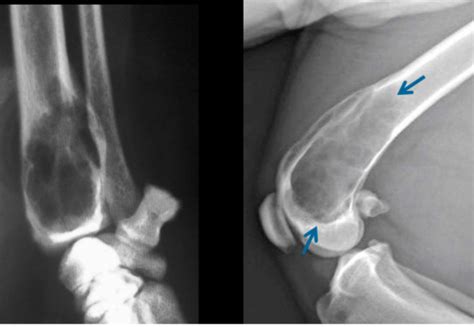 Diagnostic Imaging Exam Capps Flashcards Quizlet