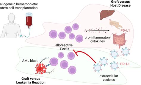 Accumulation Of T Cell Suppressive Pd L1high Extracellular Vesicles Is