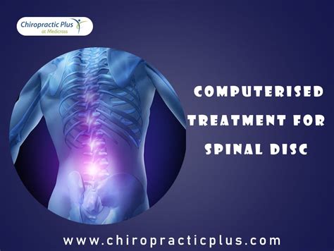 Choose Computerised Treatment For Spinal Disc For A Healthy Life ...