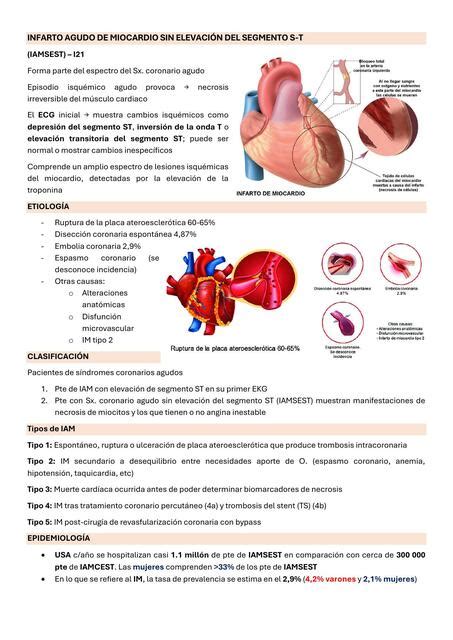 Infarto Agudo De Miocardio Sin Elevaci N Del Segmento S T Maria