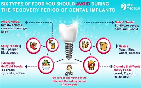 What To Eat After Dental Implants Surgery Ariamedtour