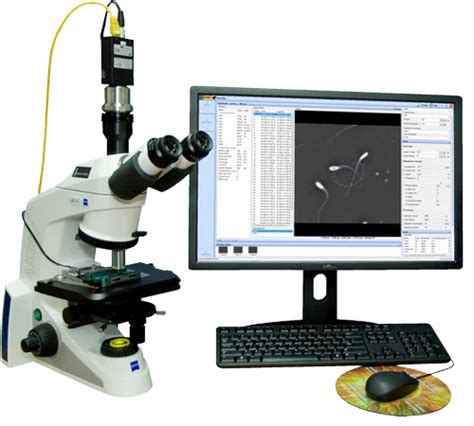 Kv Casa Automated Semen Analyzer For Laboratory Use Model Ps