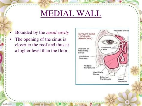 Medial Wall Of Maxillary Sinus