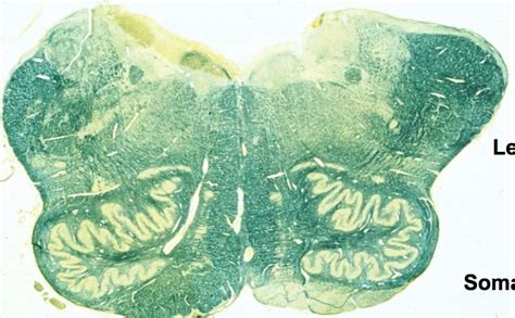 Caudal Medulla Diagram Quizlet