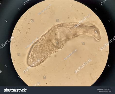 35 Demodex Mites Photos Images, Stock Photos & Vectors | Shutterstock