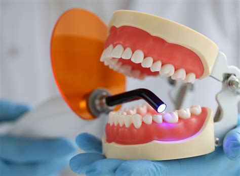 Understanding the Different Types of Tooth Fillings