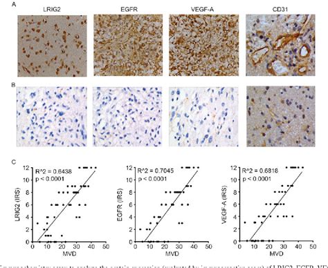 Figure 1 From Downregulation Of Lrig2 Expression Inhibits Angiogenesis