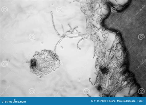 Mold at the microscope stock photo. Image of fungal - 111147622