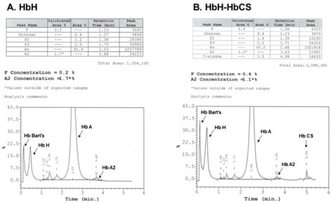 Thalassemia Reports Free Full Text Alpha Thalassemia Diversity Of Clinical Phenotypes And