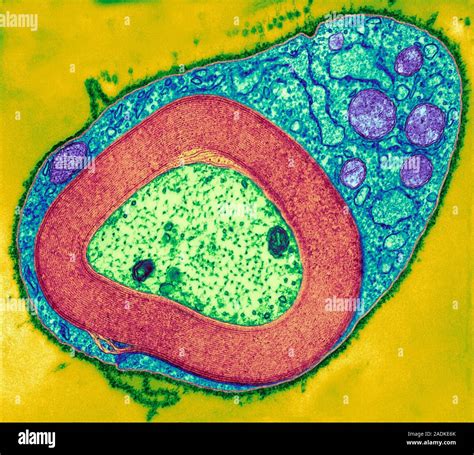 Myelinated Nerve Coloured Transmission Electron Micrograph Tem Of