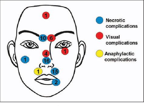 Nasolabial sulcus | Semantic Scholar