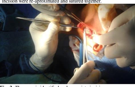 Figure From Cervical Length Measurements And Uterine Artery Doppler