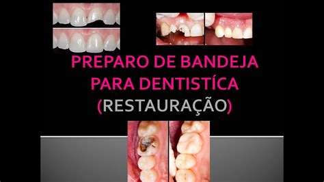 AULA 1 PREPARO DE BANDEJA DENTISTÍCA RESTAURAÇÃO YouTube