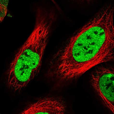 Anti Ccar Rabbit Polyclonal Biozol