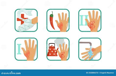 Burns Degree First Aid For Burn Wound Fire Damage To Skin