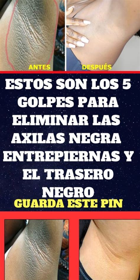 Estos Son Los 5 Golpes Para Eliminar Las Axilas Negra Entrepiernas Y El