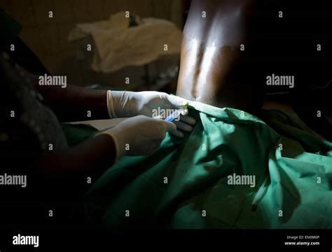 Anestesia Epidural Fotos E Im Genes De Stock Alamy