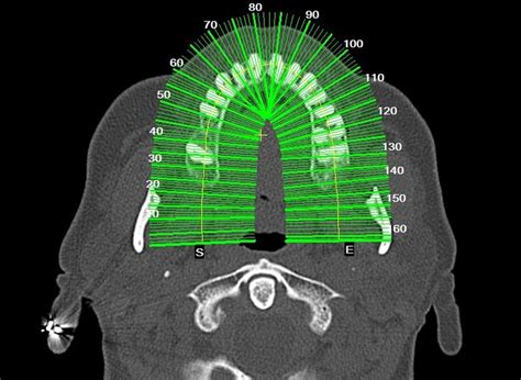 Ct Scan Showing Slices Diagnostic Imaging Implantology Magnetic Resonance Imaging