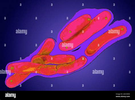 Mycobacterium tuberculosis bacteria. Coloured transmission electron ...