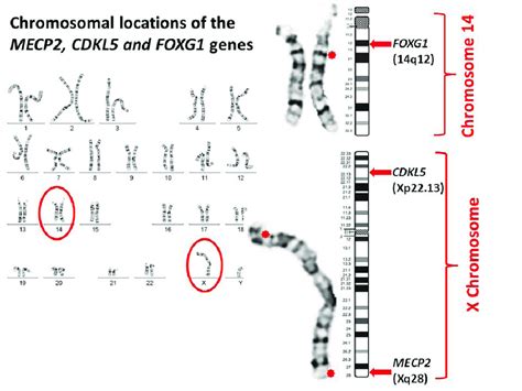 Rett Syndrome Karyotype