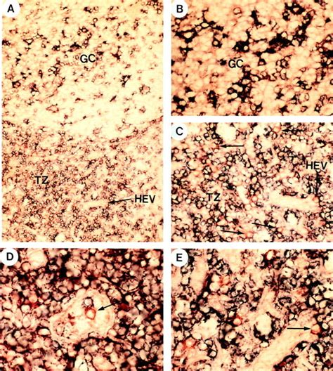 Anatomical Localization Of Cd4⁺cd11c⁻cd3⁻ Plasmacytoid Cells To