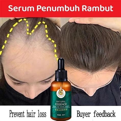 Jual HANYA 7 HARISerum Penumbuh Rambut Hair Tonic Penumbuh Rambut