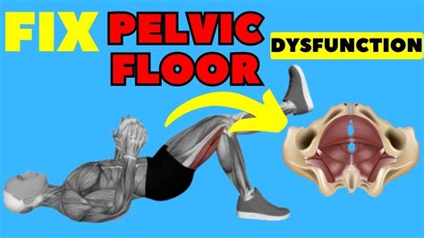 Unlocking The Secret To Defeating Male Pelvic Floor Dysfunction Youtube