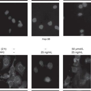 Celecoxib Blocks Il Induced Stat Nuclear Translocation Hep B Cells