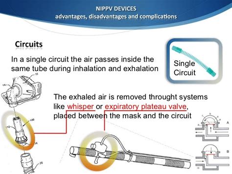 Noninvasive ventilation devices management