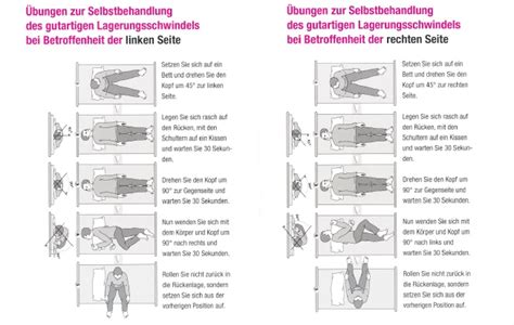 Right Sided Epley Maneuver