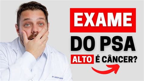 EXAME DO PSA ALTO É CÂNCER DE PRÓSTATA É POSSÍVEL REDUZIR OS NÍVEIS