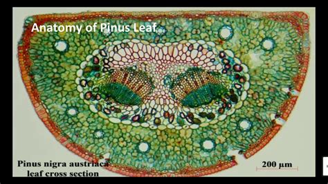 Anatomy Of Pinus Leafneedle Youtube