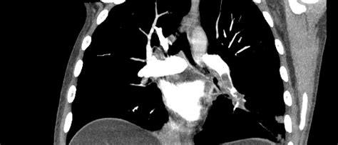 CT Protocols - Department of Radiology