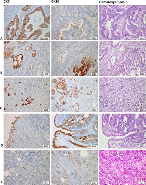 Histological Images Magnification 200x Showing A Diffusely