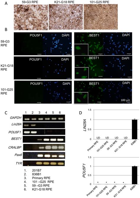 A Phase Contrast Images Of Hipsc Derived Rpe Cell Lines G Rpe