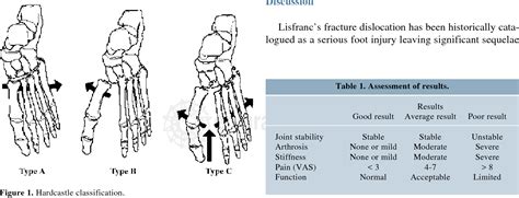 Figure 1 from Lisfranc's fracture dislocation. Epidemiological study and results at the General ...