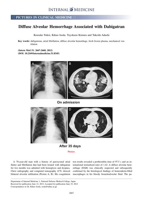 PDF Diffuse Alveolar Hemorrhage Associated With Dabigatran