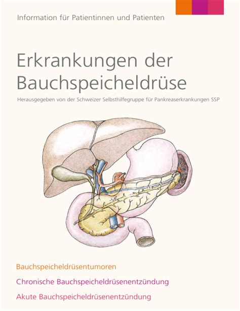 Erkrankungen der Bauchspeicheldrüse