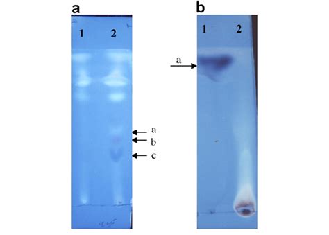 Comparison Of Tlc Chromatograms Of A Organic Phase Extract And B