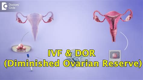 Is Ivf The Only Option For Women With Diminished Ovarian Reserve Dr