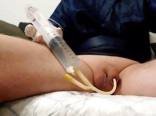 Bdsm Cum With Catheter Telegraph