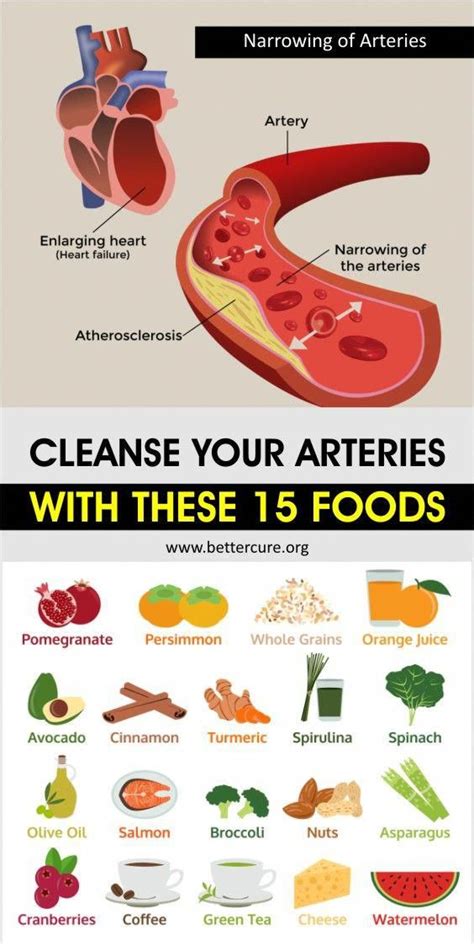 Cleanse Your Arteries With These 15 Foods In 2020 Food Cleanse