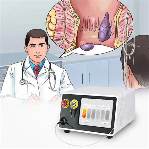 Hemorrhoids Pilonidal Proctology Cysts Laser Surgery Rectal Surgery Anal Fistulas 980nm 1470nm