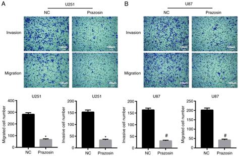 Prazosin Inhibits The Proliferation Migration And Invasion But