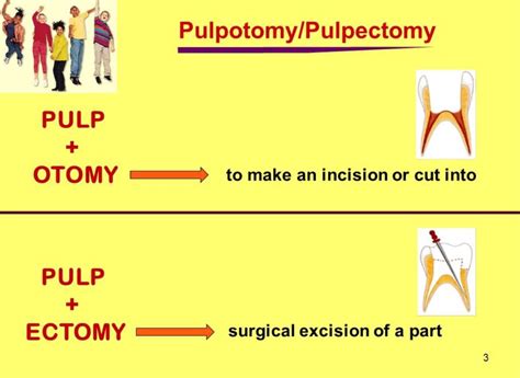 Difference Between Pulpotomy And Pulpectomy Your Full 60 OFF