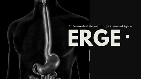 Enfermedad Por Reflujo Gastro Esofágico Erge Mz1080 Udocz