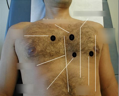 Anterior Surface Anatomy Diagram Quizlet